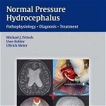 NPH - Normal Pressure Hydrocephalus: Pathophysiology - Diagnosis - Treatment