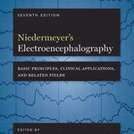 Niedermeyer's Electroencephalography: Basic Principles, Clinical Applications, and Related Fields