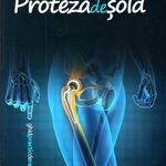 Proteza de sold. Ghid practic de recuperare - Alexandru Burlan