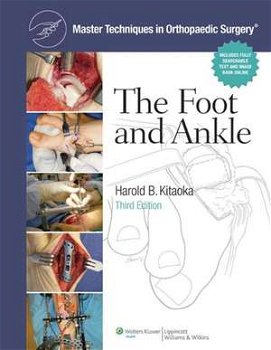 Master Techniques in Orthopaedic Surgery: The Foot and Ankle (Master Techniques in Orthopaedic Surgery)