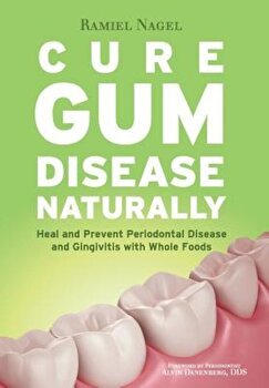 Cure Gum Disease Naturally: Heal Gingivitis and Periodontal Disease with Whole Foods, Ramiel Nagel (Author)