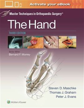 Master Techniques in Orthopaedic Surgery: The Hand (Master Techniques in Orthopaedic Surgery)