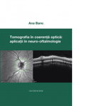 Tomografia in coerenta optica: aplicatii in neuro-oftalmologie, 