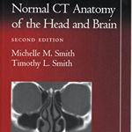 Pocket Atlas of Normal CT Anatomy of the Head and Brain (Radiology Pocket Atlas Series)