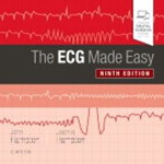 The ECG Made Easy de John R. Hampton