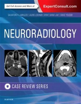 Neuroradiology Imaging Case Review (Case Review)