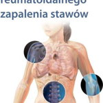 Atlas al artritei reumatoide, DK Media Poland