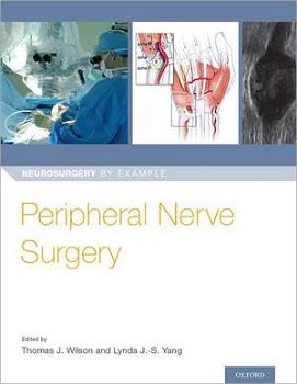Peripheral Nerve Surgery (Neurosurgery by Example)