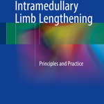 Intramedullary Limb Lengthening: Principles and Practice