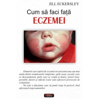 Cum să faci faţă eczemei - Paperback brosat - Jill Eckersley - Antet Revolution, 